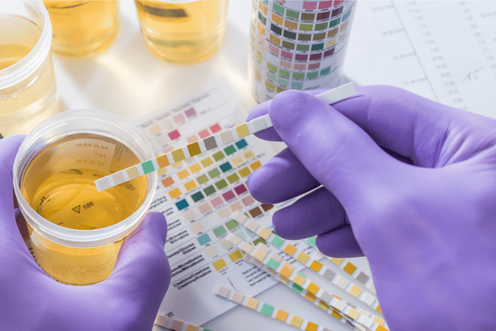 How Long Do Drugs Stay In Your System? | Avenues Recovery